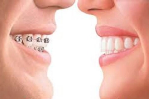 Nha Khoa Denta - Lê Văn Sỹ