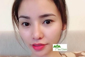 Thẩm Mỹ Mộc Liên