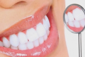 10 bí mật để có hàm răng trắng hơn
