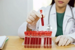 ANTI-XA là gì? Theo dõi hiệu quả heparin