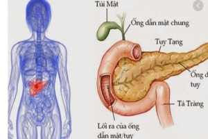 Bạn có thể sống mà không có tuyến tụy hay không?