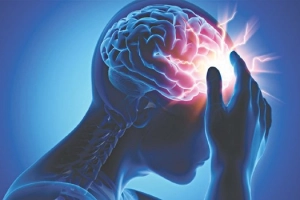 Bất sản động mạch não là gì?