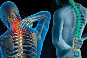 Bệnh gai cột sống có chữa được không?
