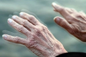 Bệnh Parkinson có di truyền và có lây không?