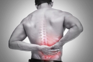 Bệnh rễ thần kinh là gì?