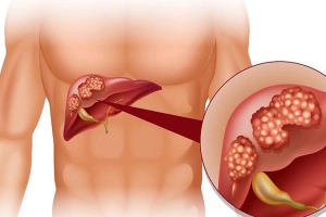 Bệnh viêm gan B có lây qua đường hô hấp không?