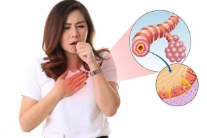Bệnh viêm phế quản mãn tính có chữa được không?