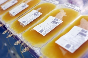 Biến chứng của thủ thuật thay huyết tương và một số báo cáo nghiên cứu trong và ngoài nước