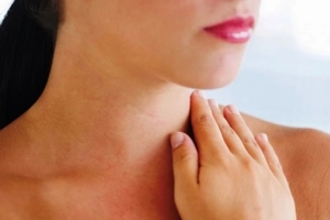 Bướu cổ giai đoạn đầu có dễ nhận diện?