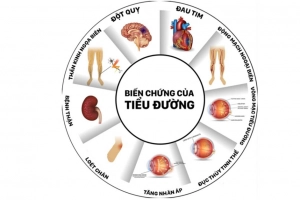 Các biến chứng tiểu đường thường gặp