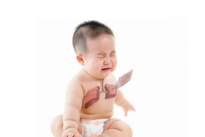 Các biểu hiện nặng của bệnh viêm phổi ở trẻ em