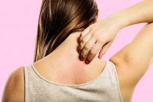 Các dấu hiệu dị ứng nghiêm trọng