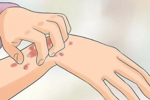 Các dấu hiệu nhiễm HIV sau 3 tháng