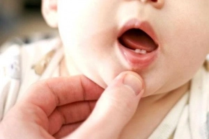 Các dấu hiệu và triệu chứng mọc răng ở trẻ