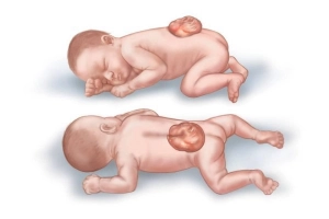 Các dị tật thai nhi được tầm soát như thế nào?