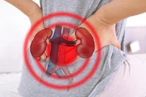 Các nguyên nhân gây đau quặn thận