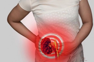 Các trường hợp suy thận mạn có chỉ định chạy thận nhân tạo