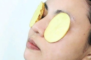 Cách làm mặt nạ trị mụn bằng khoai tây