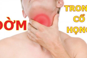 Cách làm tan đờm trong cổ họng