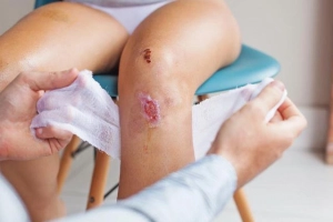 Cách rửa vết thương hoại tử
