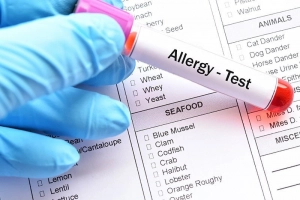 Cách test dị ứng đạm sữa bò cho trẻ