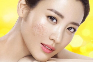 Cách trị lành sẹo hiệu quả có thể thực hiện tại nhà