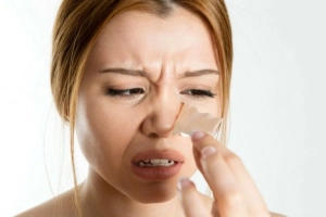 Cách trị mụn đầu đen ở mũi và lỗ chân lông to