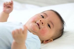 Cách xét nghiệm dị ứng đạm sữa bò