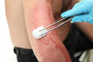 Cảnh giác bỏng và hạ thân nhiệt khi tắm cho trẻ sơ sinh mùa lạnh