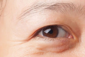 Cảnh giác mắt bị lão hóa sớm