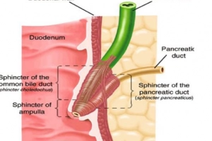 Cập nhật bệnh lý rối loạn chức năng Oddi