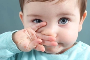 Chăm sóc da, tắm cho bé khi bị tay chân miệng