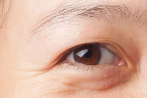 Chăm sóc vùng da quanh mắt bị lão hóa