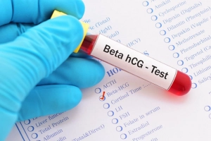 Chỉ số Beta tăng chậm sau chuyển phôi