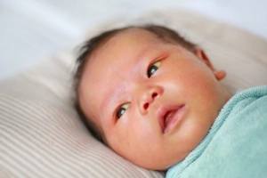 Chỉ số bilirubin vàng da ở trẻ sơ sinh