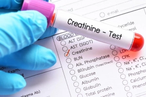 Chỉ số Creatinin thấp cho biết điều gì?