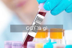 Chỉ số Gamma GT 165.00 tăng cao có sao không?