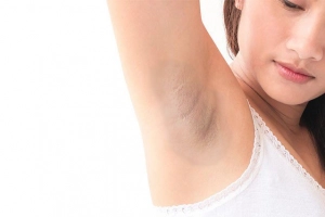 Có cách nào trị thâm nách không?