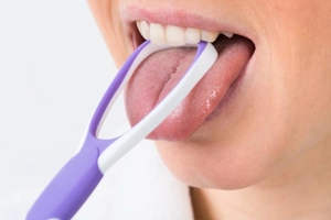 Có cần cạo lưỡi hàng ngày sau khi đánh răng?