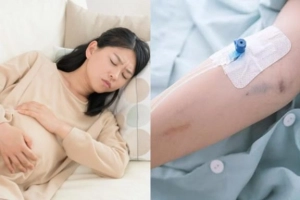 Có nên truyền nước cho bà bầu?