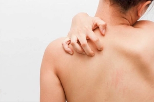 Cơ thể bị ngứa là thiếu chất gì?