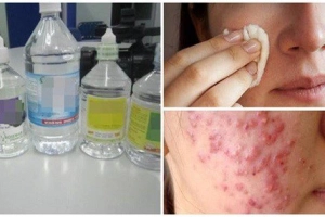 Có thể dùng nước muối sinh lý để rửa mặt?