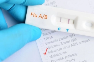 Có thể test cúm A bằng cách nào?