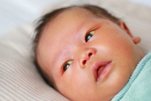 Có xét nghiệm nào chẩn đoán vàng da ở trẻ sơ sinh không?