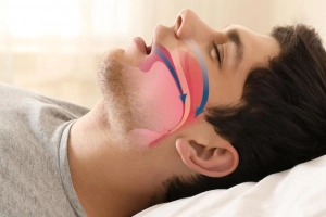 Đặc điểm của cơn ngưng thở khi ngủ