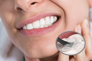 Đau nhức răng kèm đau đầu là bệnh gì?