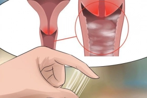 Điều trị viêm âm đạo do Trichomoniasis