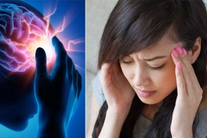 Đột quỵ thời COVID - Đừng để lỡ mất “giờ vàng”