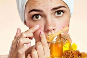 Dùng cách trị mụn bằng mật ong có tốt không?