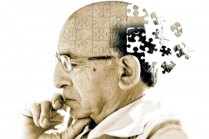 Gây mê có làm tăng nguy cơ mắc bệnh Alzheimer?